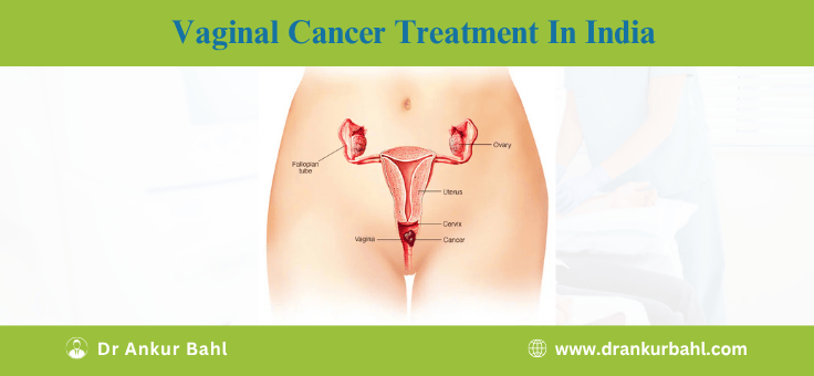 Vaginal Cancer Treatment Cost in India