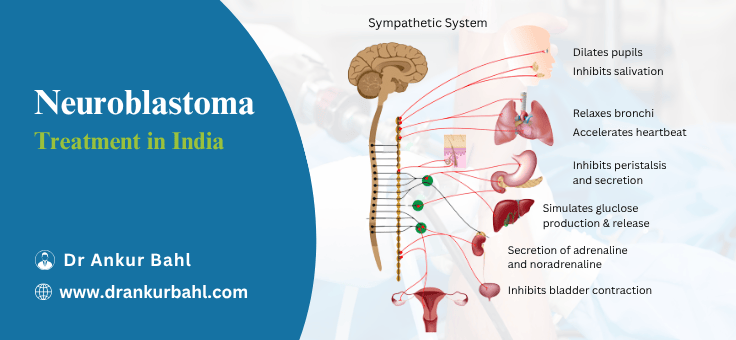 Neuroblastoma Treatment in India