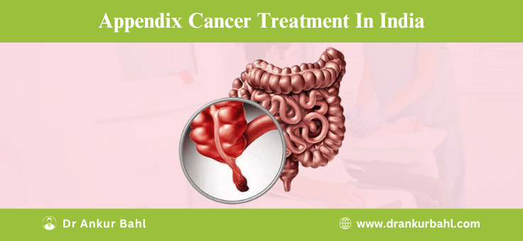 Appendix Cancer Treatment Cost in India