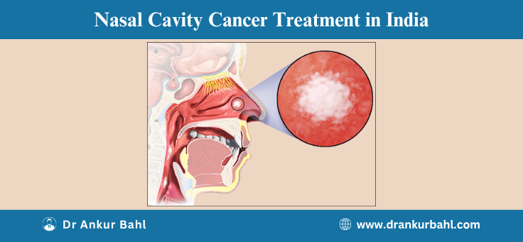 Paranasal Sinus and Nasal Cavity Cancer Treatment in India