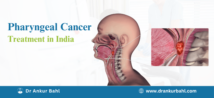 Pharyngeal Cancer (Head and Neck) Treatment in India