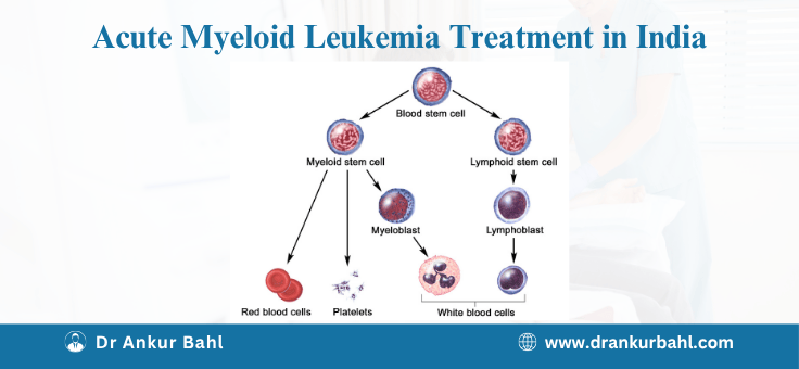 Acute Myeloid Leukemia (AML) Treatment in India