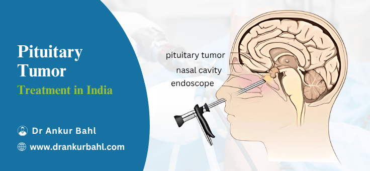 Pituitary Tumor Treatment Cost in India