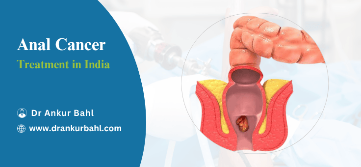 Anal Cancer Treatment Cost in India