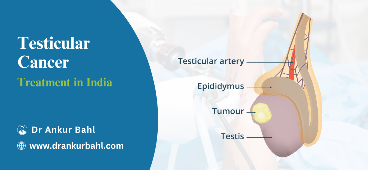 Testicular Cancer Treatment Cost in India