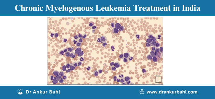 Chronic Myelogenous Leukemia (CML) Treatment in India