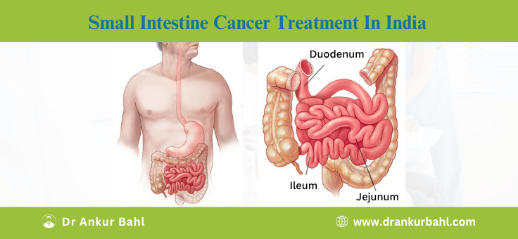 Small Intestine Cancer Treatment in India