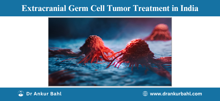 Extracranial Germ Cell Tumor Treatment in India