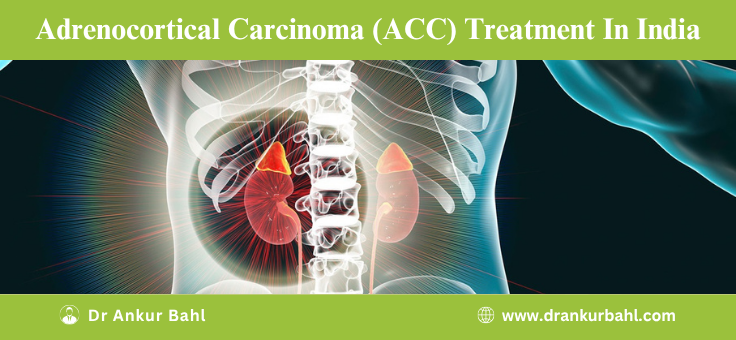 Adrenocortical Carcinoma (ACC) Treatment in India