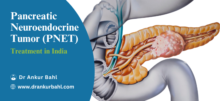 Pancreatic Neuroendocrine Tumor (PNET) Treatment in India